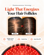 Bareglow FolliPulse 850™