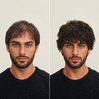 Bareglow | Vitamin Active Hair Root Cause Fixer